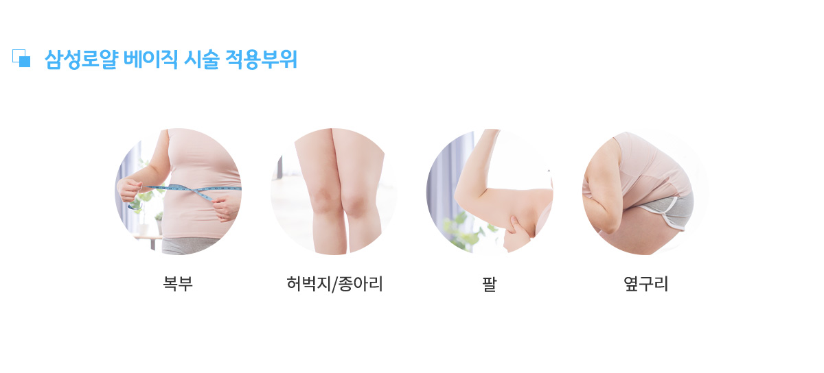 삼성로얄 베이직 시술 적용부위,
					복부, 허벅지/종아리, 팔, 옆구리