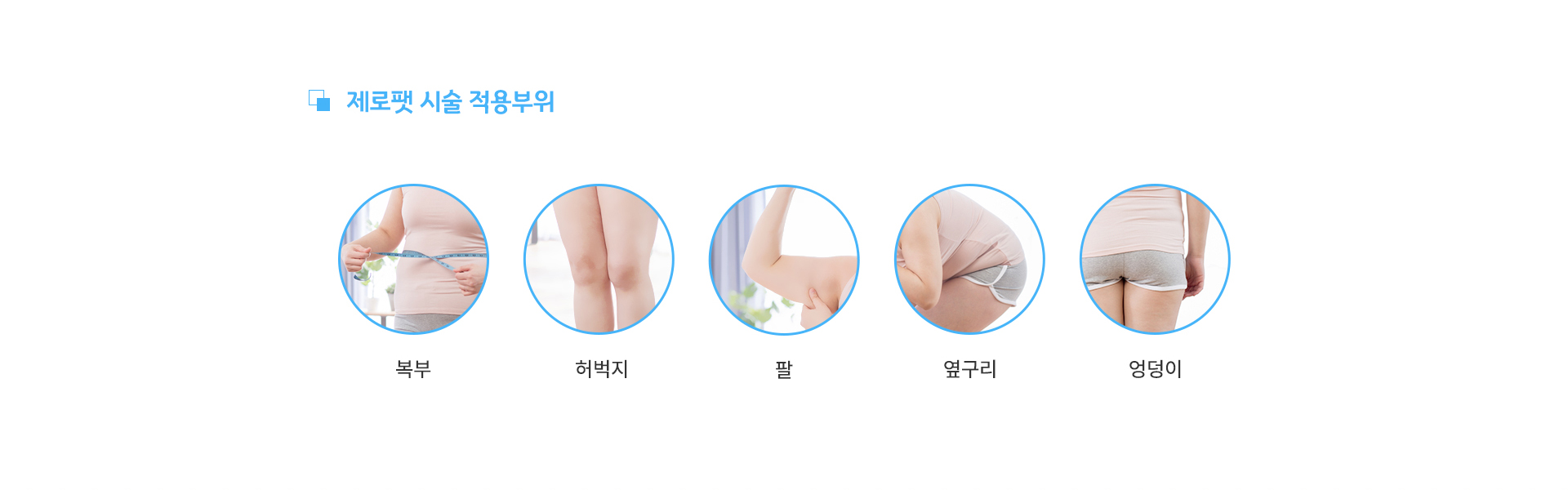 제로팻 시술 적용부위는? 복부, 허벅지, 팔,	옆구리, 엉덩이
