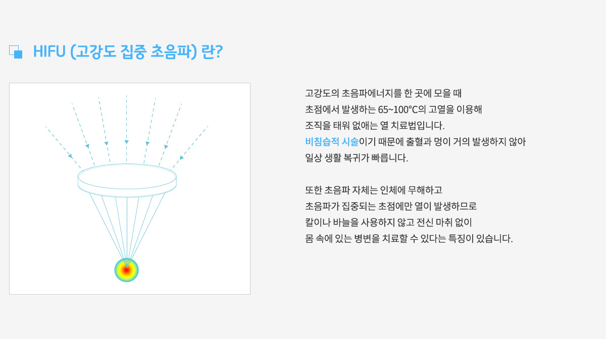 HIFU(고강도집중초음파)란,
					고강도의 초음파에너지를 한곳에 모을때
					초점에서 발생하는 65~100도씨의 고열을 이용해
					조직을 태워 없애는 열 치료법입니다.
					비침습적 시술이기 때문에 출혈과 멍이 거의 발생하지 않아
					일상 생활 복귀가 빠릅니다.
					또한 초음파 자체는 인체에 무해하고
					초음파가 집중되는 초점에만 열이 발생하므로
					칼이나 바늘을 사용하지 않고 전신 마취 없이
					몸 속에 있는 병변을 치료할 수 있다는 특징이 있습니다.