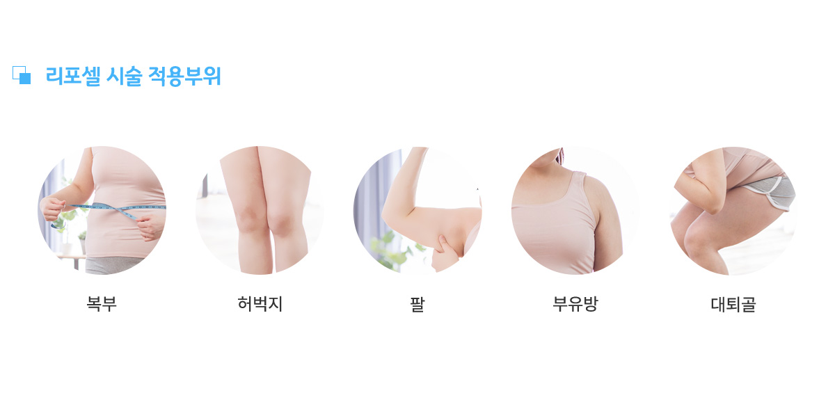 리포셀 시술 적용부위,
					복부, 허벅지, 팔, 부유방, 대퇴골