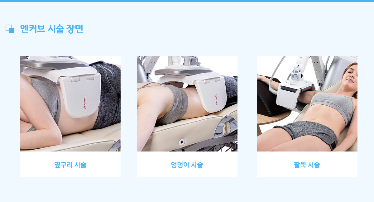 엔커브 시술 장면, 옆구리시술, 엉덩이시술, 팔뚝시술