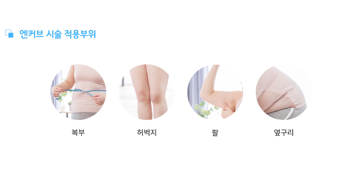 엔커브시술적용부위, 복부, 허벅지, 팔, 옆구리