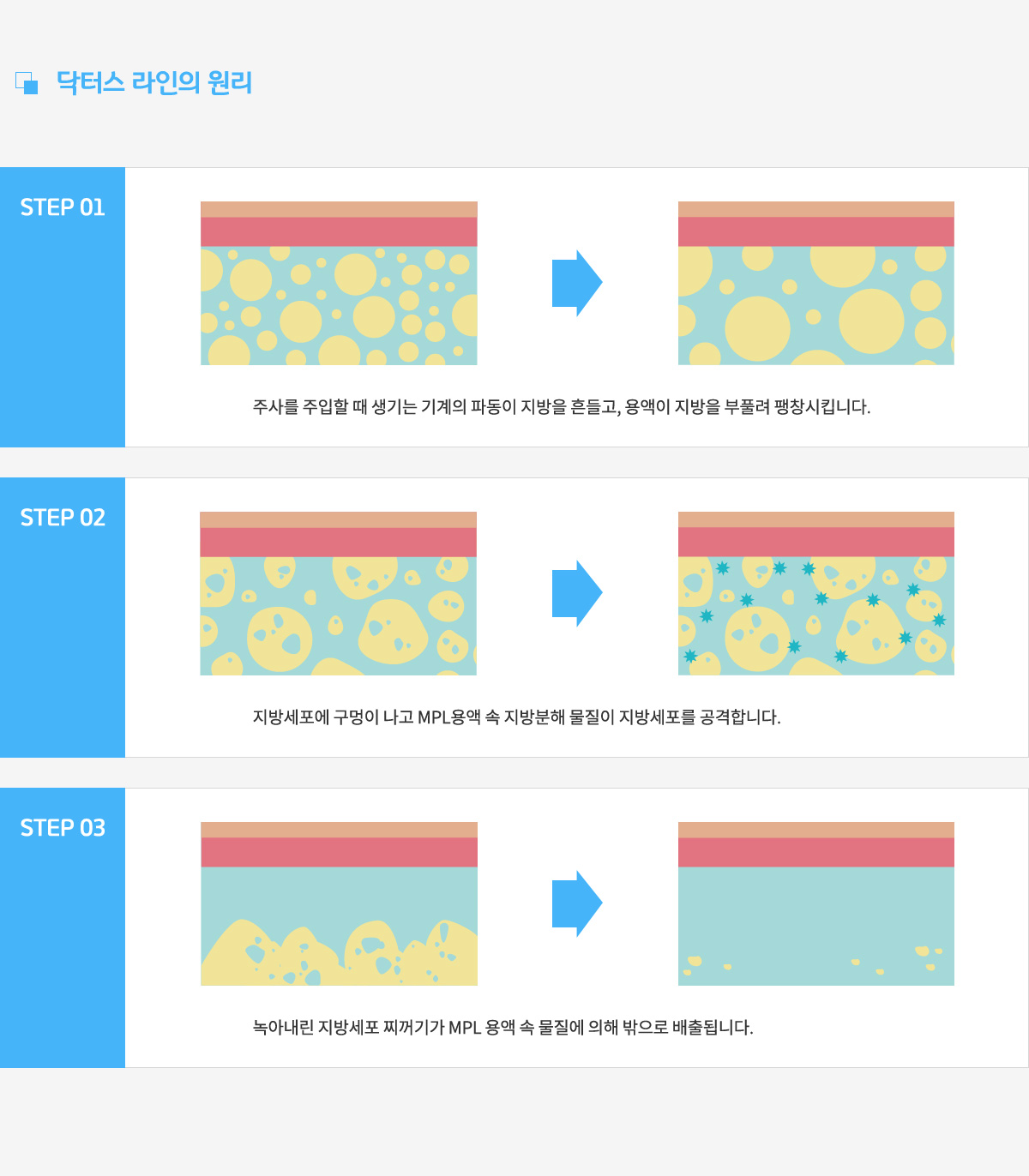 닥터스 라인의 원리,
					1. 주사를 주입할 때 생기는 기계의 파동이 지방을 흔들고, 용액이 지방을 부풀려 팽창시킵니다.
					2. 지방세포에 구멍이 나도 MPL용액 속 지방분해 물질이 지방세포를 공격합니다.
					3. 녹아내린 지방세포 찌꺼기가 MPL 용액 속 물질에 의해 밖으로 배출됩니다.