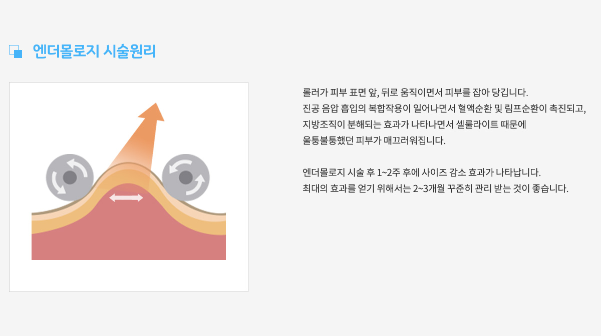 엔더몰로지 시술원리, 롤러가 피부 표면 앞, 뒤로 움직이면서 피부를 잡아 당깁니다. 진공 음압 흡입의 복합작용이 일어나면서 혈액순환 및 림프순환이 촉진되고, 지방조직이 분해되는 효과가 나타나면서 셀룰라이트 때문에 울퉁불퉁했던 피부가 매끄러워집니다.
					엔더몰로지 시술 후 1~2주 후에 사이즈 감소 효과가 나타납니다.
					최대의 효과를 얻기 위해서는 2~3개월 꾸준히 관리 받는 것이 좋습니다.